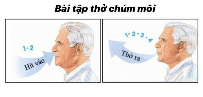 Kỹ thuật thở chúm môi.