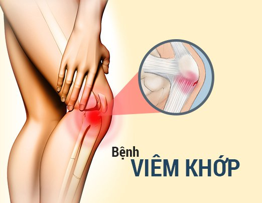 Lá ô liu giúp cải thiện bệnh viêm khớp