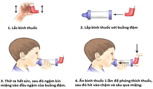 Cách dùng bình hít định liều và buồng đệm