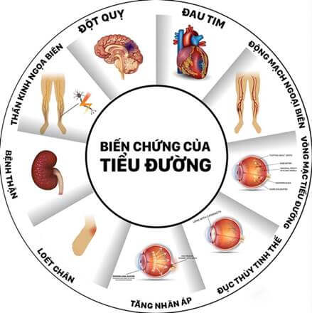 Chỉ số HbA1c an toàn giúp bệnh nhân ngăn ngừa biến chứng bệnh tiểu đường