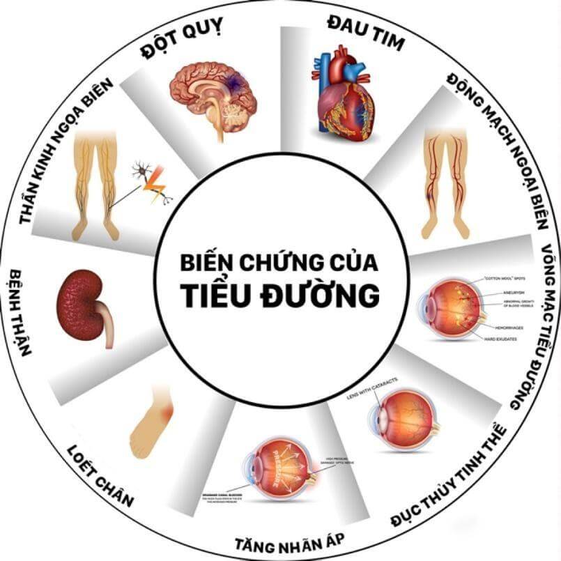 Biến chứng mãn tính của bệnh tiểu đường