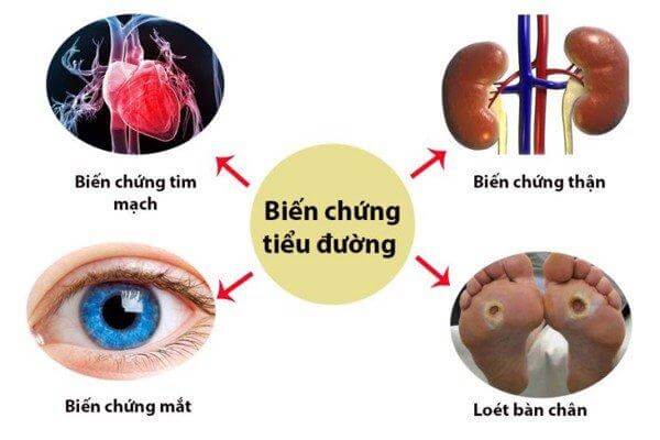 Biến chứng khác của bệnh tiểu đường