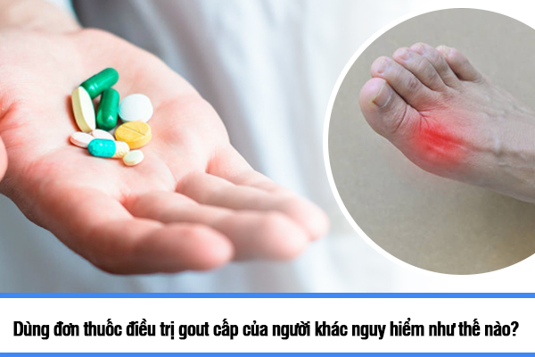 Dùng đơn thuốc điều trị gout cấp của người khác nguy hiểm như thế nào?