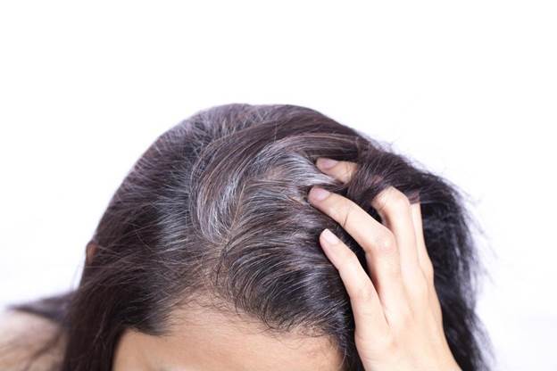 BoniHair có trị bạc tóc do di truyền không?