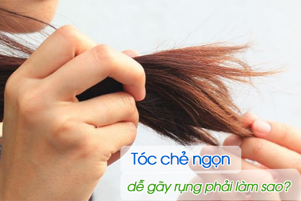 Tóc chẻ ngọn, dễ gãy rụng phải làm sao?