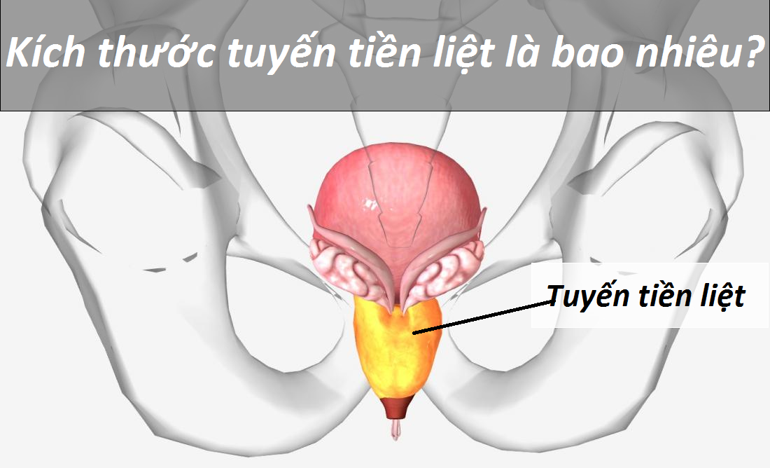 Kích thước tuyến tiền liệt bình thường và khi bị phì đại là bao nhiêu?