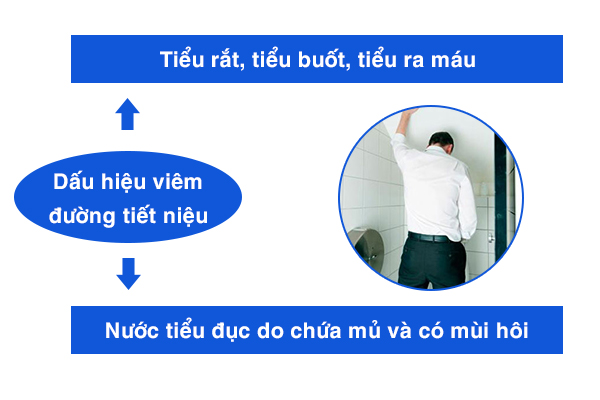 Viêm đường tiết niệu ở nam giới - Biến chứng phổ biến của bệnh u xơ tuyến tiền liệt