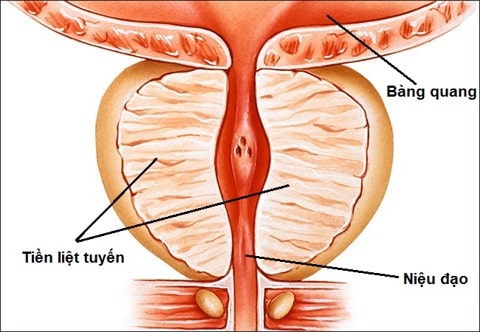 Chuyên gia giải đáp: Kích thước tuyến tiền liệt bao nhiêu là phì đại?