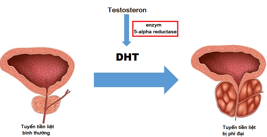 Cơ chế tăng sinh tuyến tiền liệt