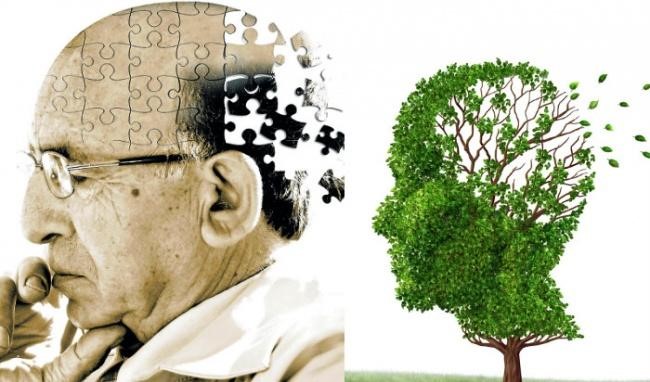 Bệnh Alzheimer