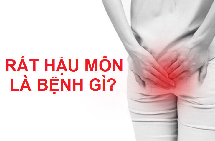 Bị rát hậu môn là bệnh gì? Làm sao để để cải thiện?