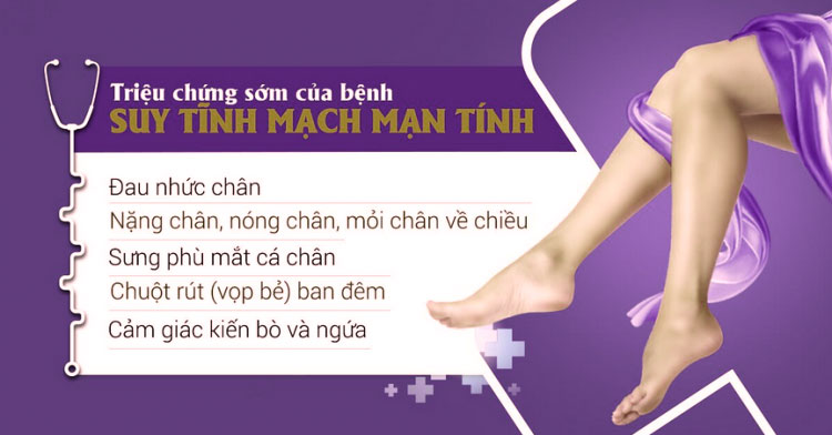 Một số triệu chứng điển hình của suy giãn tĩnh mạch