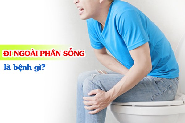 Đi người phân sống là bệnh gì?