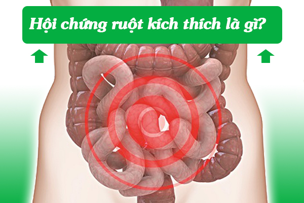 Hội chứng ruột kích thích có nguy hiểm không?