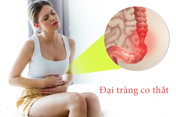 Những điều cần biết về bệnh đại tràng co thắt