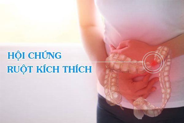 Hội chứng ruột kích thích - Đâu là cách phòng ngừa hiệu quả?