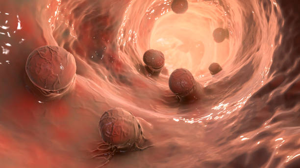 Hình ảnh polyp đại tràng