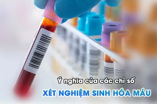 Ý nghĩa của các chỉ số xét nghiệm sinh hóa máu