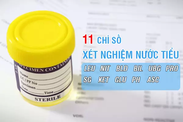 11 chỉ số xét nghiệm nước tiểu nói gì về sức khỏe của bạn?