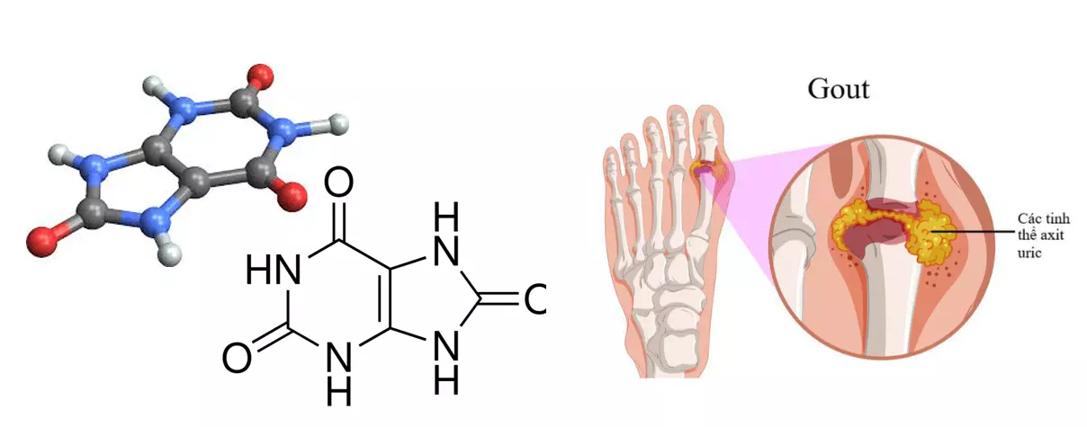 Cần tây giúp hạ acid uric trong máu