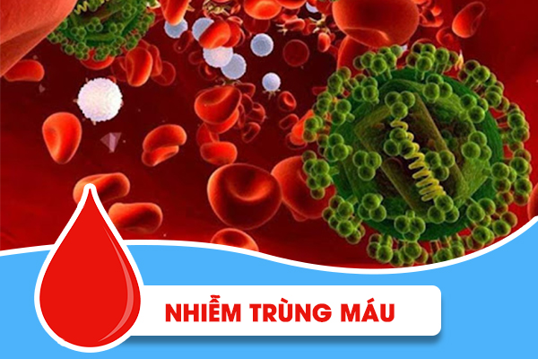 Nhiễm trùng máu - Một vấn đề đặc biệt nguy hiểm mà bạn cần phải đề phòng