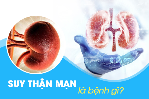 Suy thận mạn là bệnh gì?