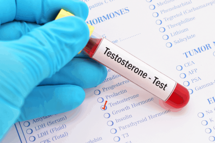 Tổng quan về testosterol: khái niệm, vai trò