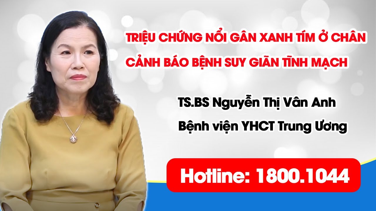 VTV2 - Triệu chứng nổi gân xanh tím ở chân cảnh báo bệnh suy giãn tĩnh mạch rất nguy hiểm